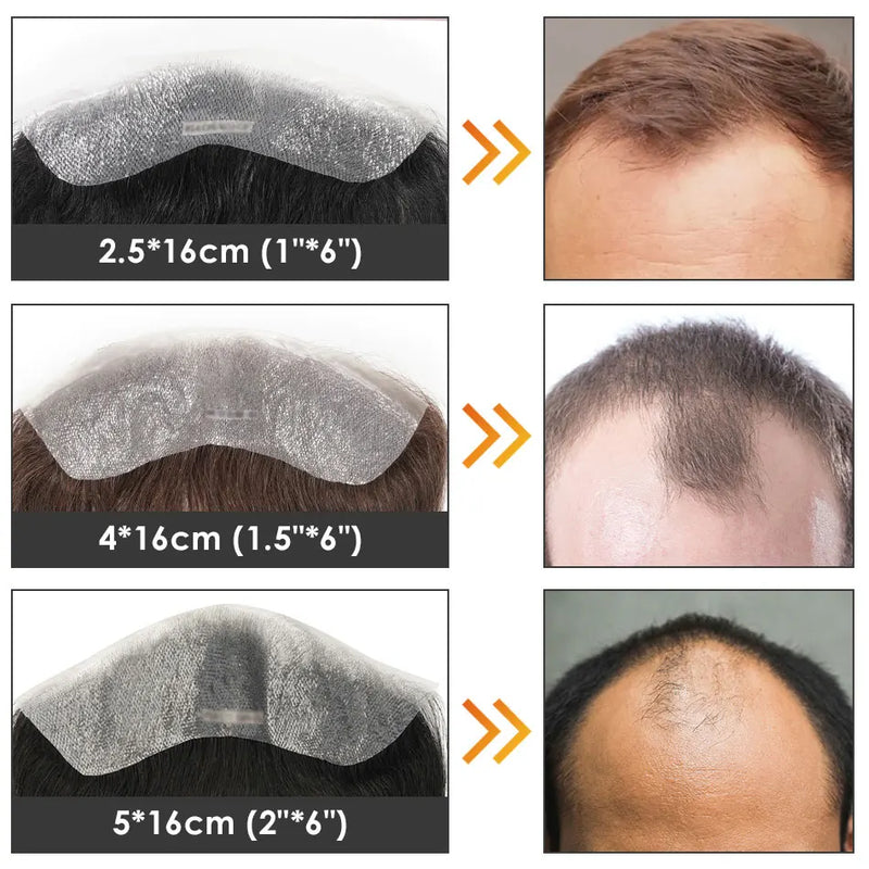 FRONTAL 15cm, 0.06mm, sem nós,  para homens, peruca ultrafina, pele pu, prótese capilar masculina.